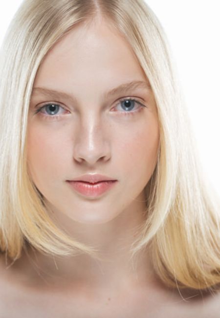 Radiofrecuencia facial en Alcorcón